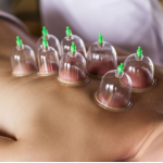 Cupping Dao Holistic