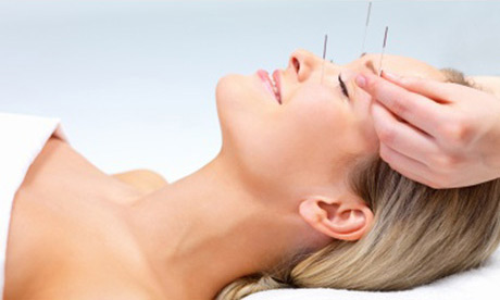 Facial acupuncture Dao Holistic