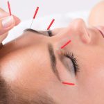 Dao Holistic Facial Acupuncture