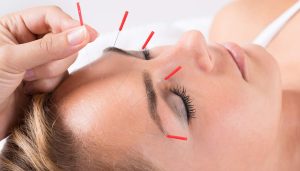 Dao Holistic Facial Acupuncture